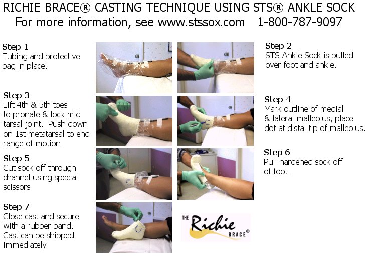 Richie Brace® Allied Osi Labs 2218